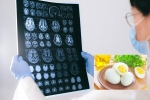 Eggs and Alzheimer’s news, Eggs, eggs may help prevent alzheimer s study, Animal
